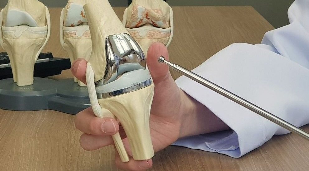 Best Knee Replacement Surgery in Delhi