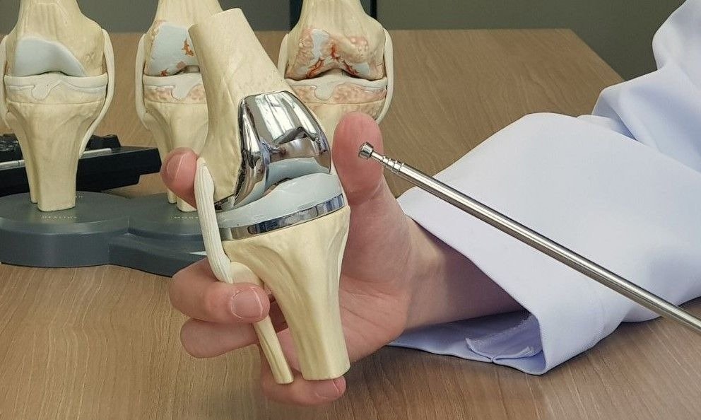 Best Knee Replacement Surgery in Delhi