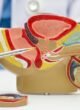 Stricture Urethra Treatment in Narela Stricture Urethra Treatment in Narela