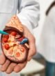 Kidney Cancer Surgeon in Narela