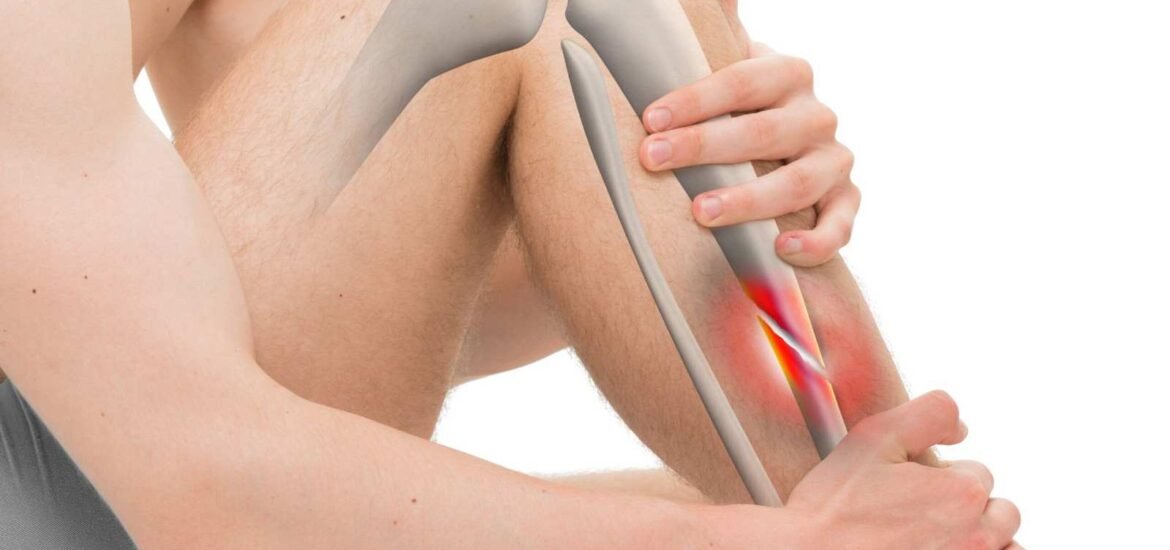 Bone Fracture Surgery in Narela Bone Fracture Surgery in Narela